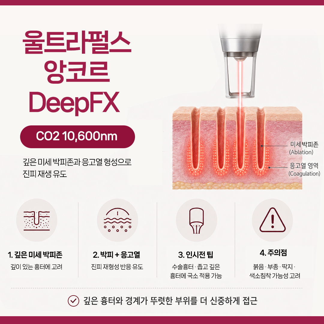 울트라펄스앙코르 인시전 팁과 DeepFX를 설명하는 이미지