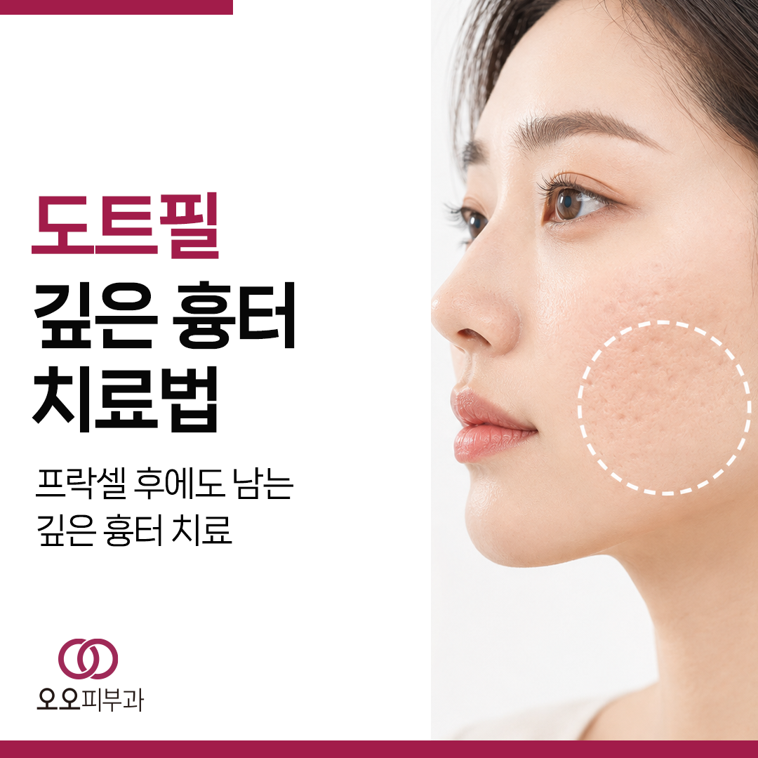 도트필이 필요한 여드름흉터