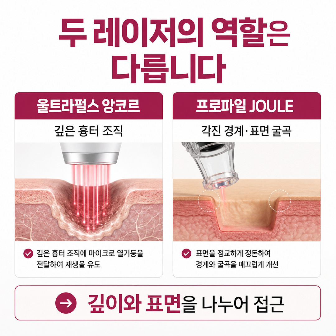 울트라펄스 앙코르와 프로파일 JOULE 복합시술 후 1일 4일 8일 회복 과정