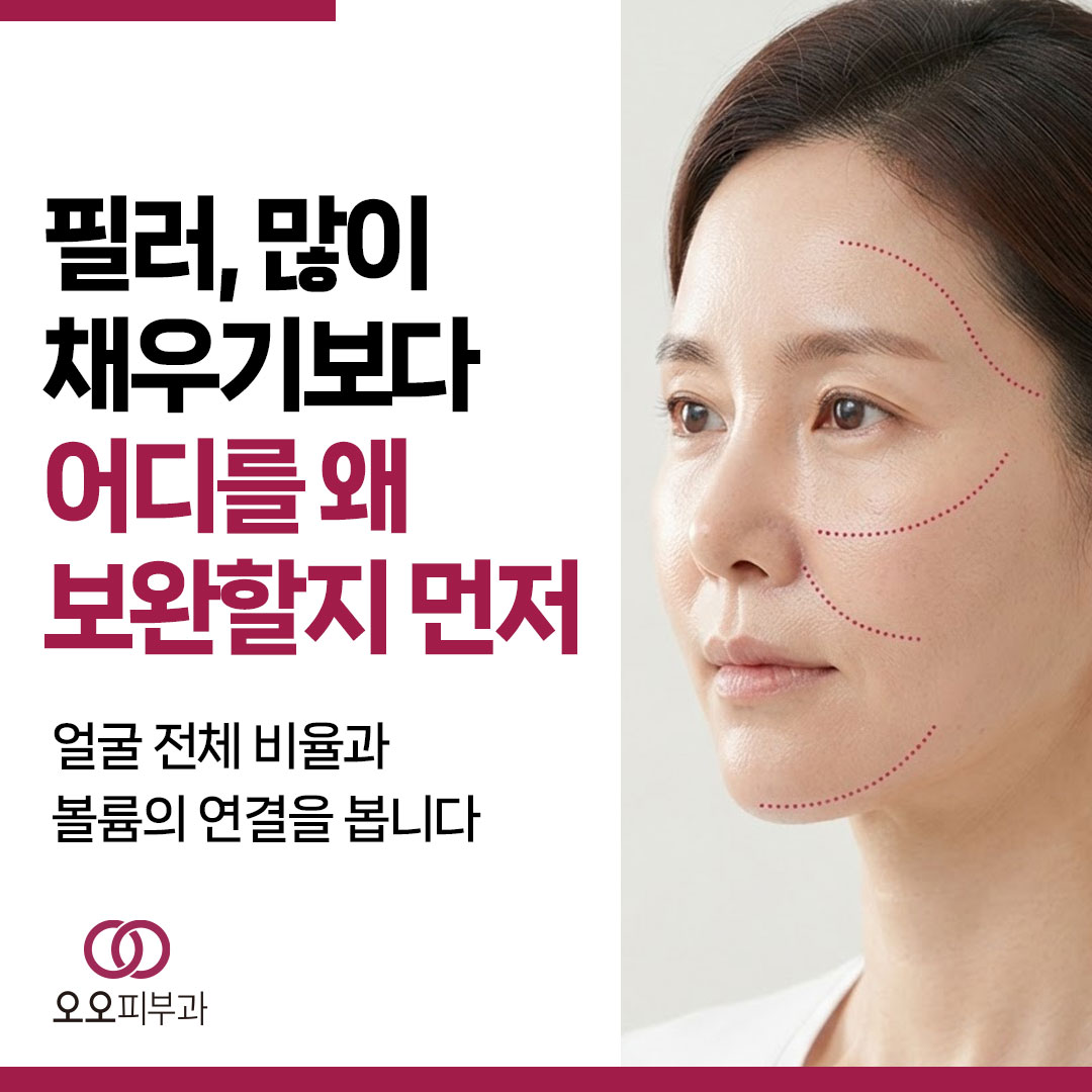 필러, 꺼진 곳을 모두 채우는 시술은 아닙니다