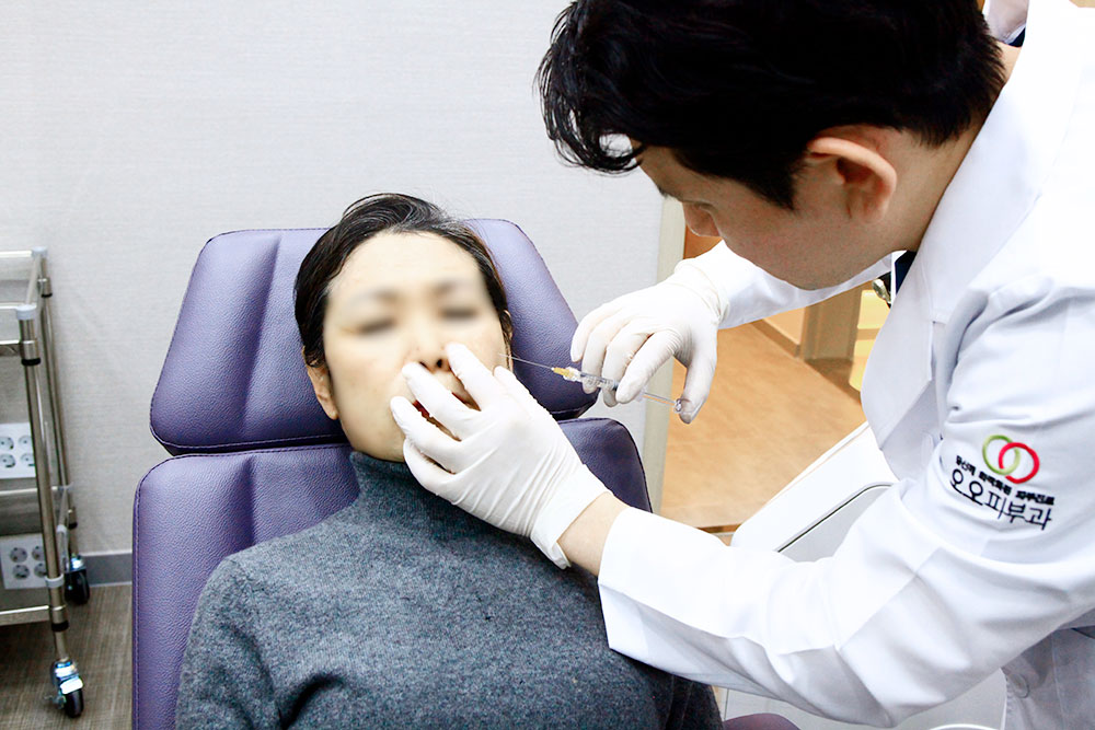 대구필러 실제 시술 장면