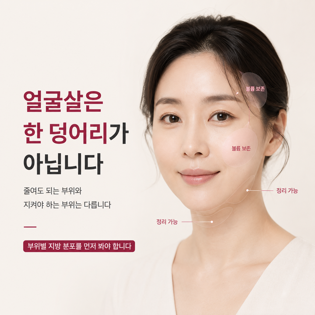 대구리니어지 HIFU 후 볼패임과 얼굴 지방 구획별 볼륨 보존 설명