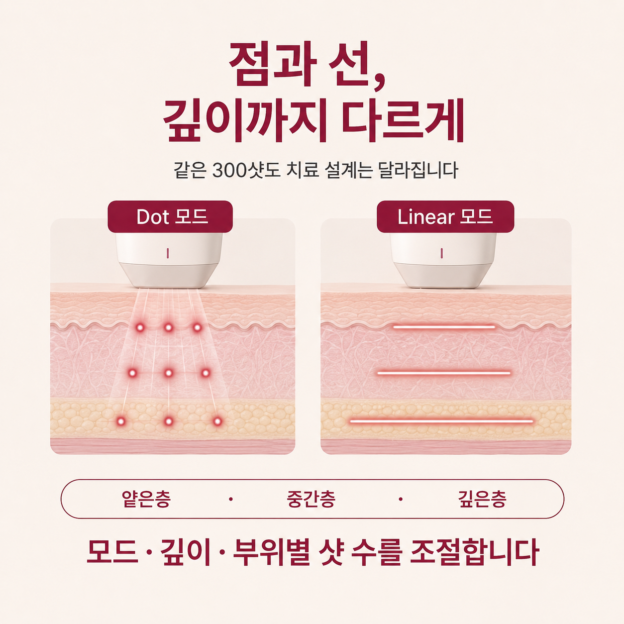 대구리니어지 Dot Linear 모드와 피부층별 깊이 조절 원리
