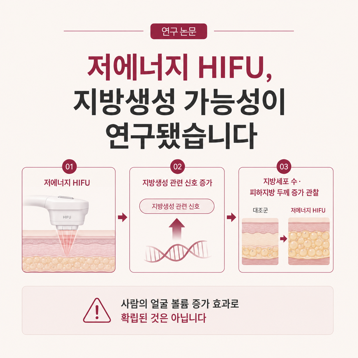 리니어지 저에너지 HIFU 지방세포 수와 피하지방 두께 증가 동물 연구 설명