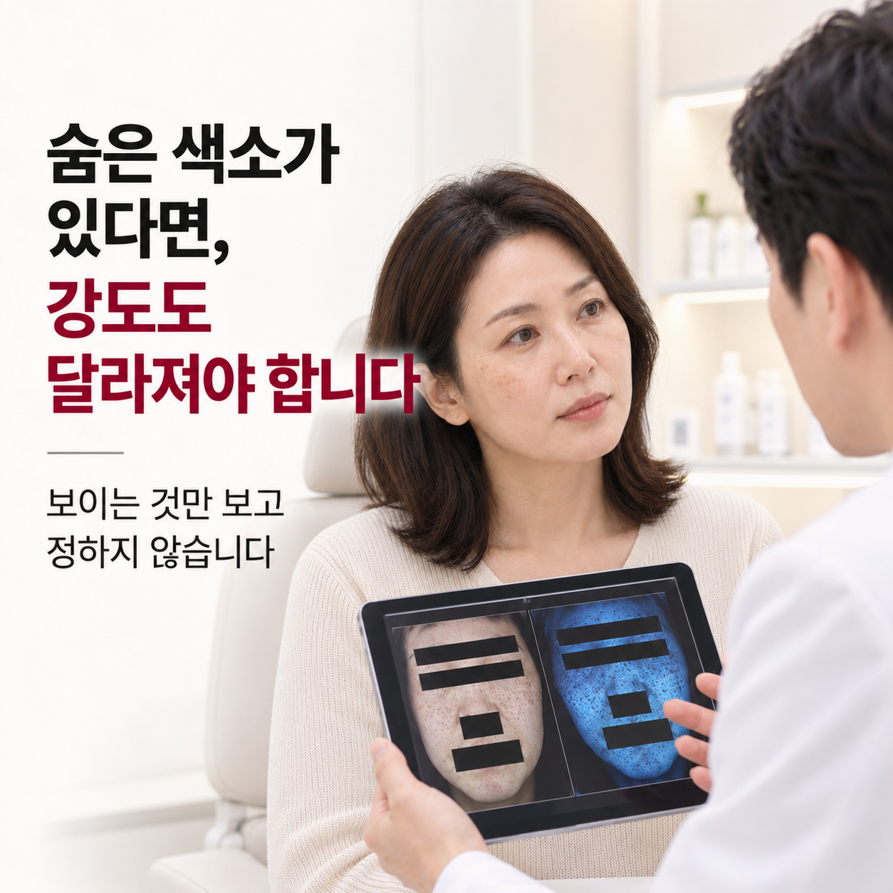 숨은 기미 색소 유무에 따라 레이저 강도를 달리 보는 피부과 전문의 상담 이미지