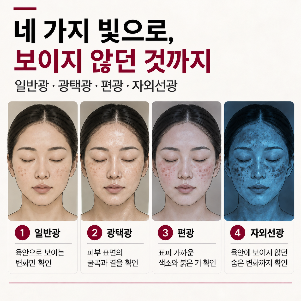 마크뷰 일반광 광택광 편광 자외선광을 이용한 대구기미잡티피부과 색소 확인