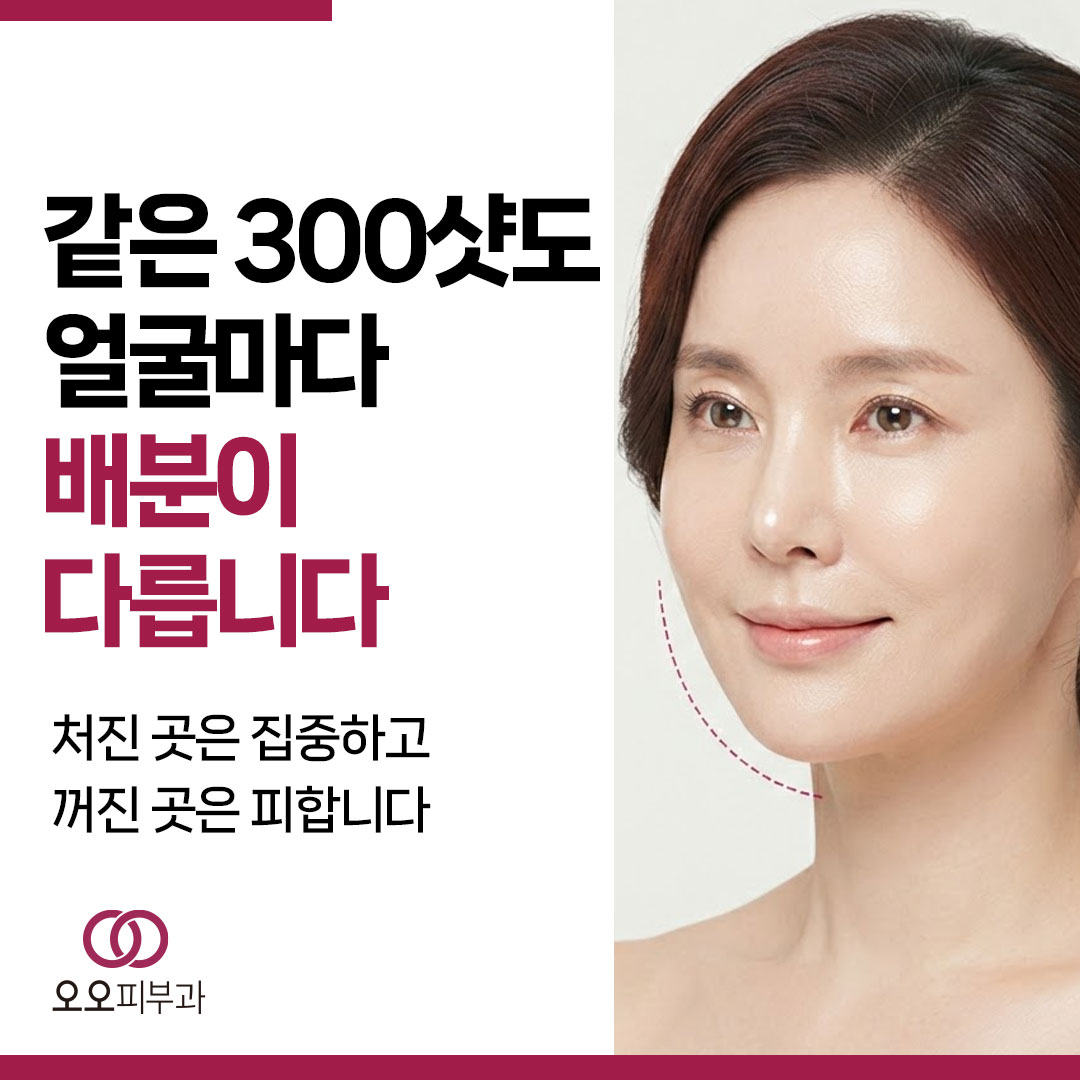 슈링크, 얼굴형과 처짐 부위에 따라 샷 배분이 달라집니다