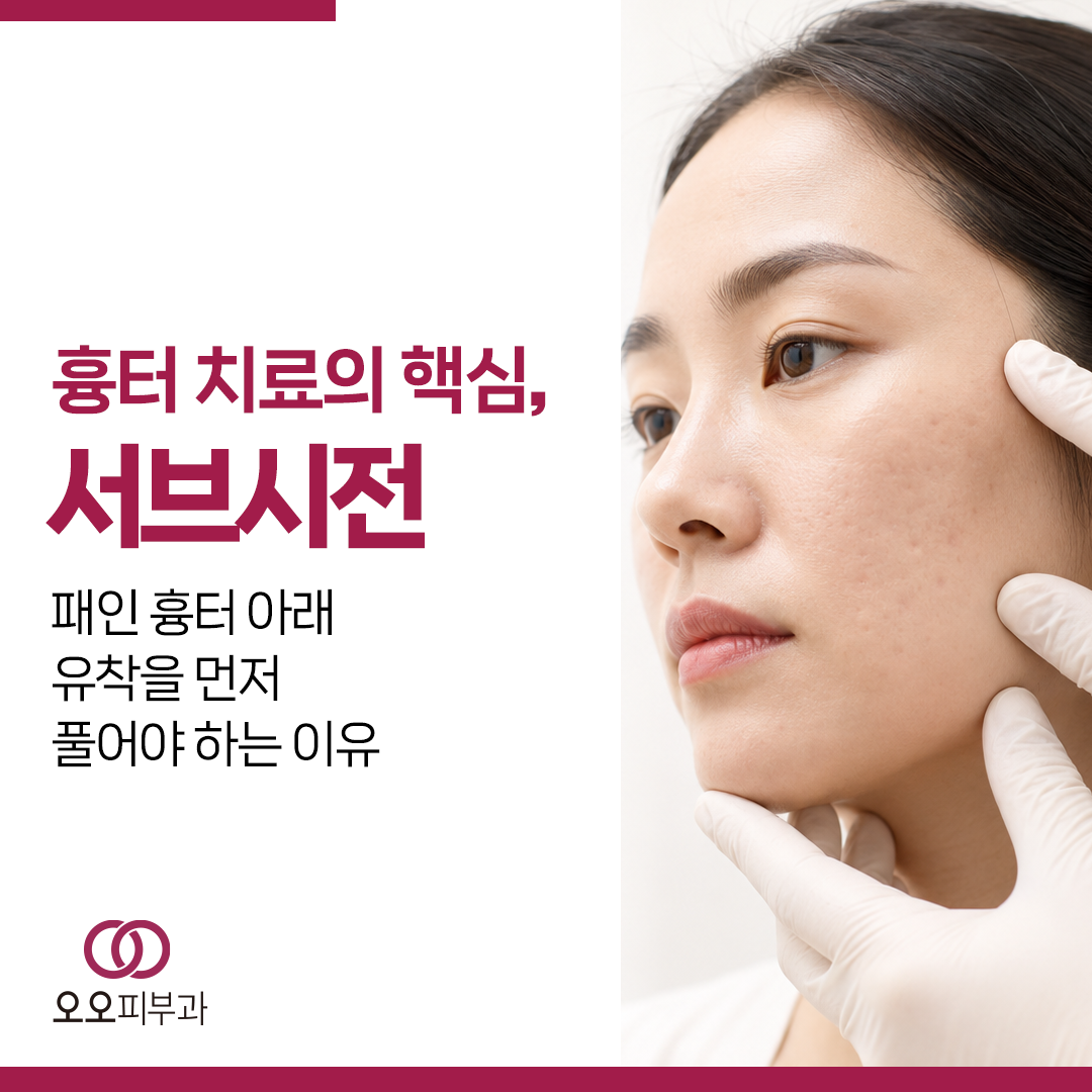 패인 흉터 치료 전 피부 아래 유착을 확인하는 이유