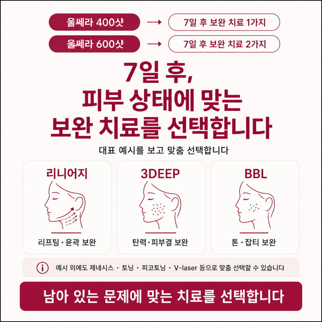 울쎄라 600샷 후 리니어지 3DEEP BBL 선택 기준