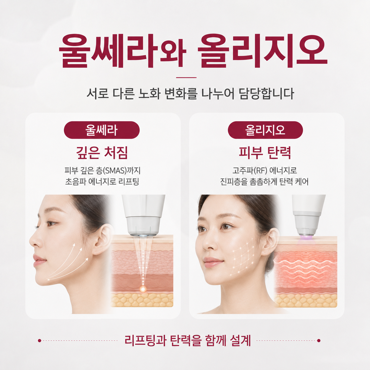 대구울써마지 울쎄라 깊은 처짐과 올리지오 피부 탄력 역할