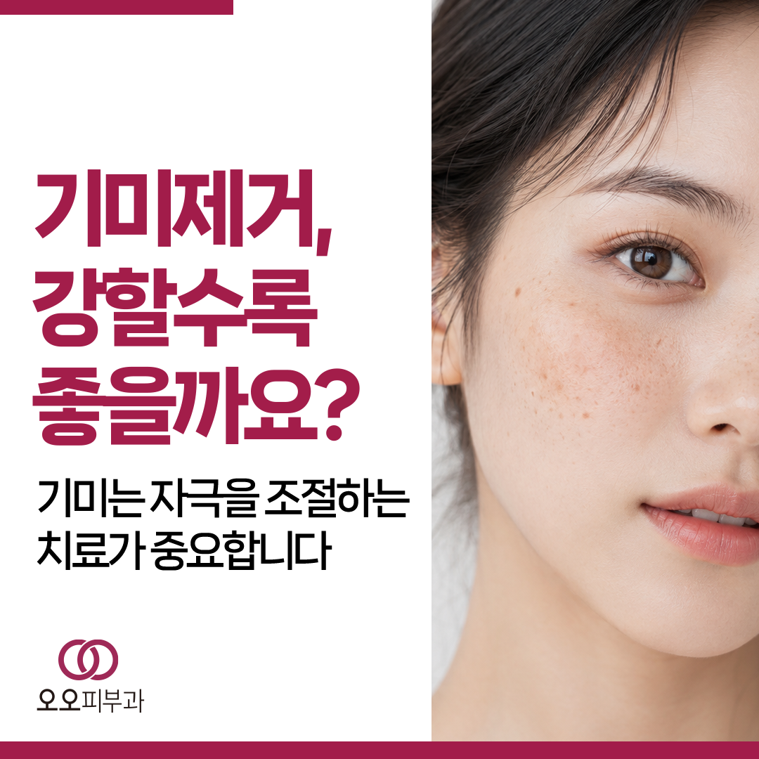 기미 치료에서 강한 레이저만이 답이 아닌 이유
