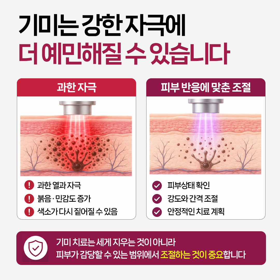 달서구 기미제거 시 딱지와 붉음이 치료 효과의 기준은 아니라는 안내 이미지
