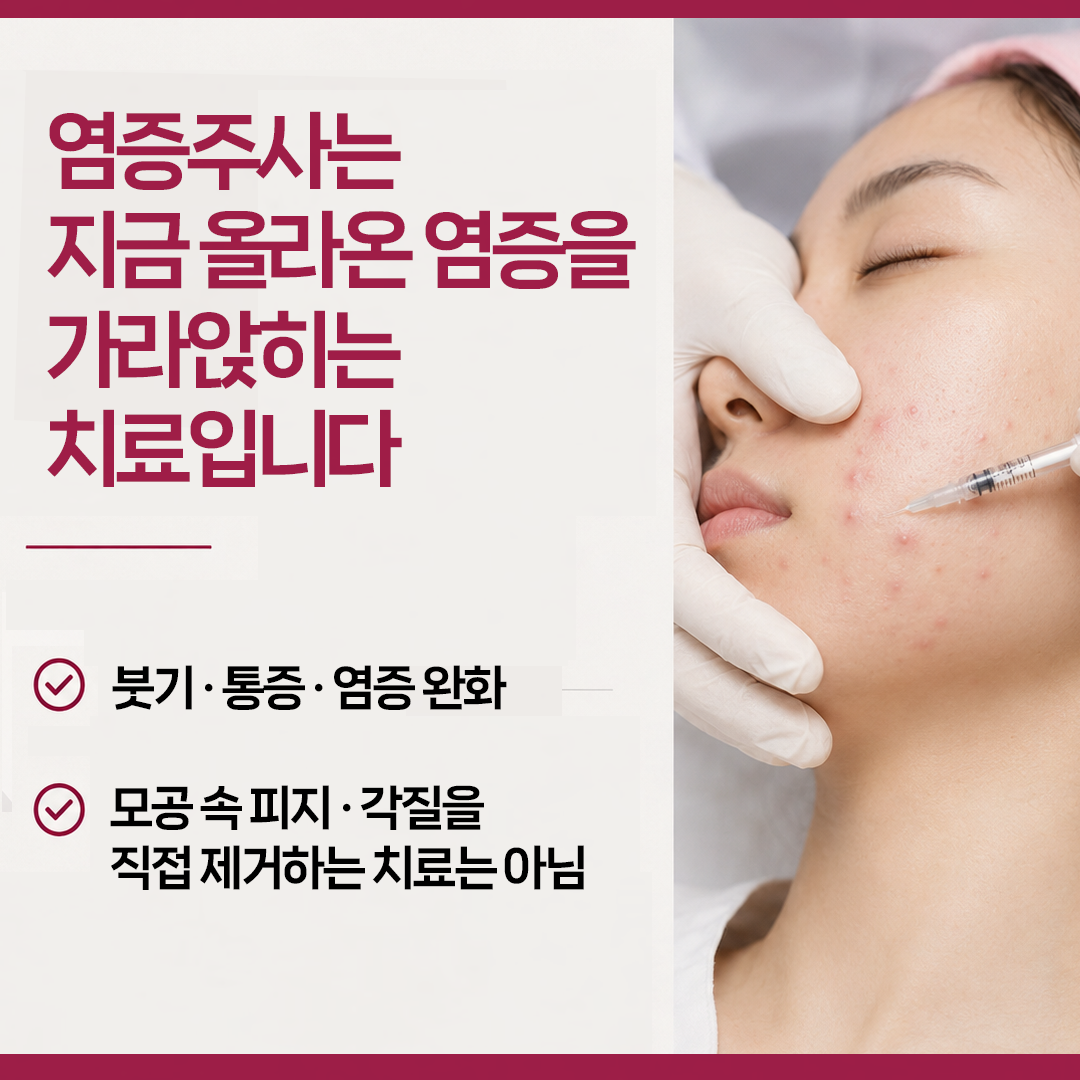 현풍피부과 염증주사가 붓기와 통증을 낮추지만 면포를 직접 제거하지 않는 역할을 설명하는 이미지