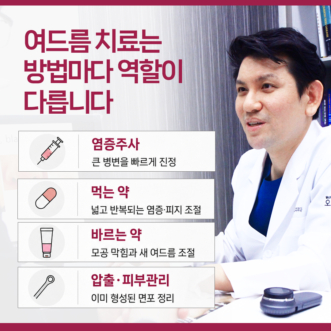 현풍피부과 여드름 염증주사 약물치료 압출 피부관리 BBL 420nm 역할 비교