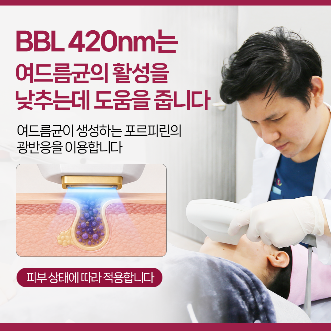 현풍피부과 여드름 치료에서 BBL 420nm가 포르피린 광반응을 이용해 여드름균 활성과 염증 조절에 도움을 주는 원리