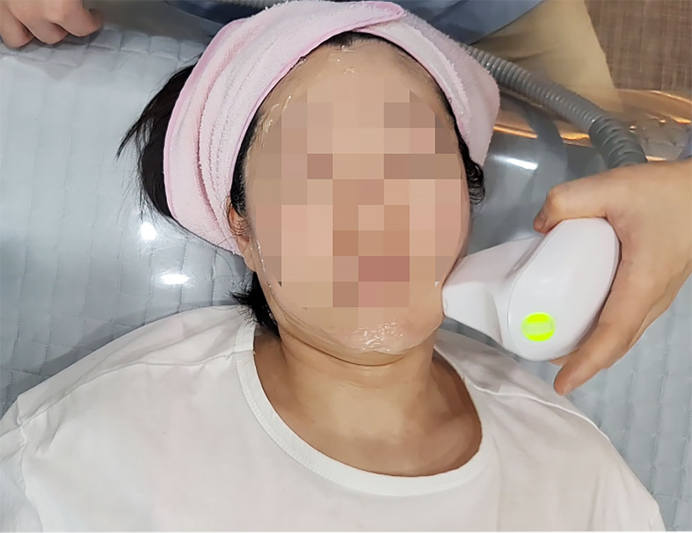 대구쓰리딥 3DEEP 고주파 리프팅