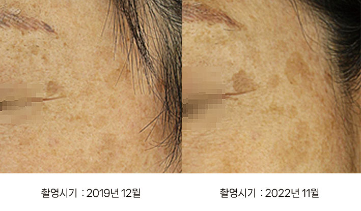 일광흑자 3년 경과 - 2019년 vs 2022년 악화 비교