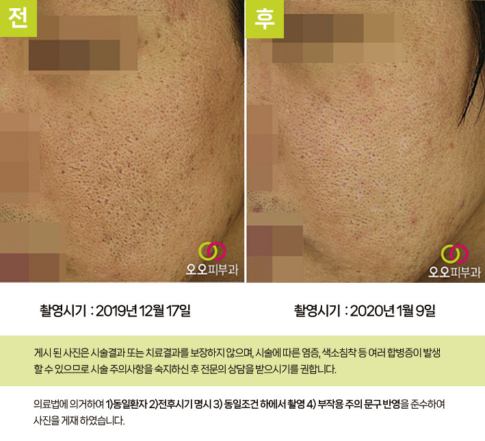 복합 치료 전