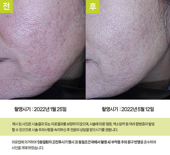 복합 치료 전